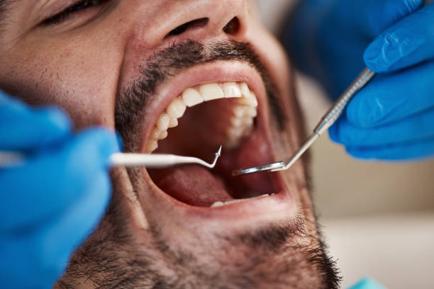 Dental Bonding in Point Roberts, WA